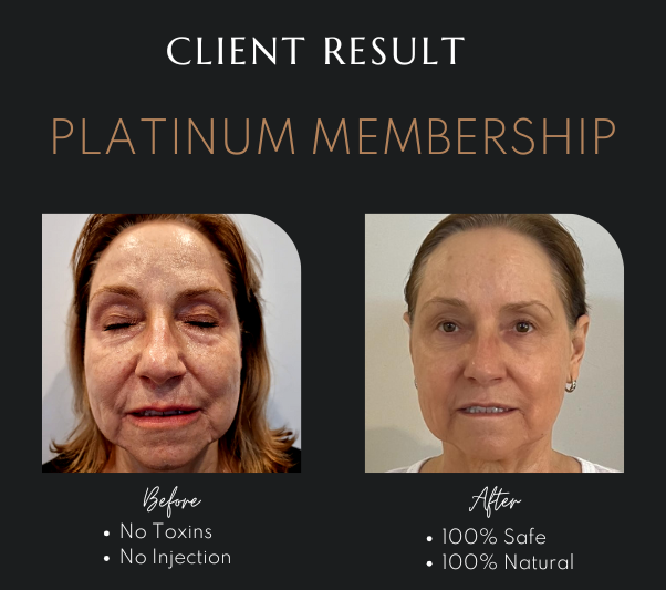 Hydro Facial in Newcastle