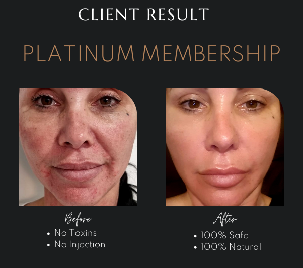 Natural Anti-Aging Treatments Newcastle