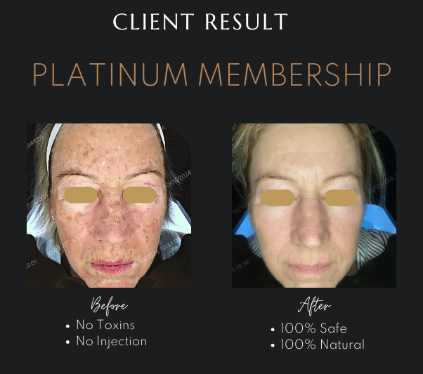 Advanced Skin Treatments Newcastle