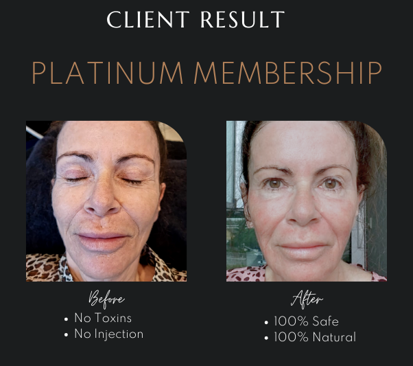 Best Membership Skin Clinic Newcastle