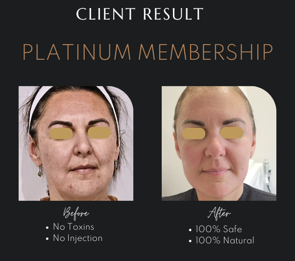 Non-Surgical Skin Solutions Newcastle