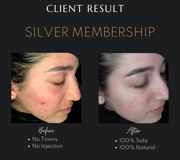 Fibroblast Plasma Treatment in Newcastle