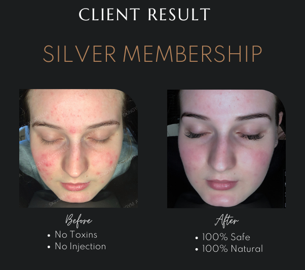 LED Infusion Therapy in Newcastle