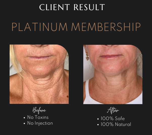 Best Membership Skin Clinic Newcastle