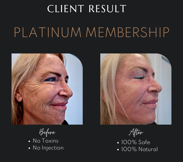 Fibroblast Plasma Treatment in Newcastle