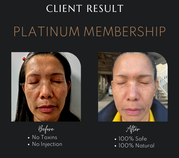 Problem Skin Clinic Newcastle