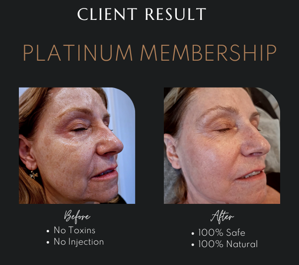 Natural Anti-Aging Treatments Newcastle