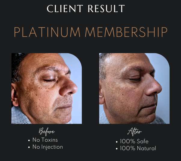 Hydro Facial in Newcastle