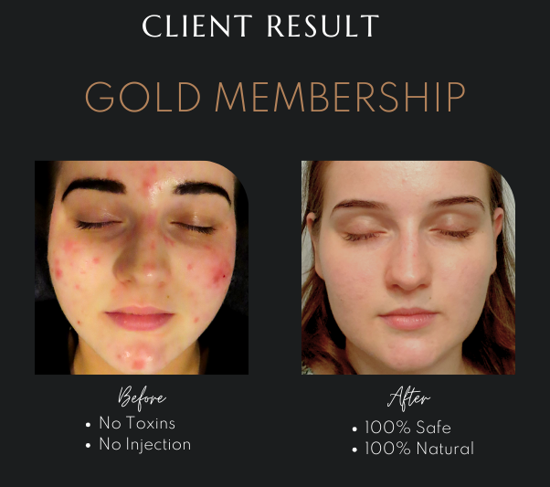 Advanced Skin Treatments Newcastle