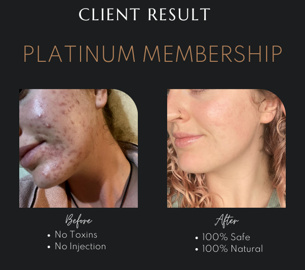 Natural Skin Rejuvenation Australia