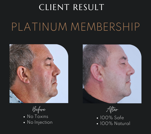 Plasma Infusion Facial Newcastle