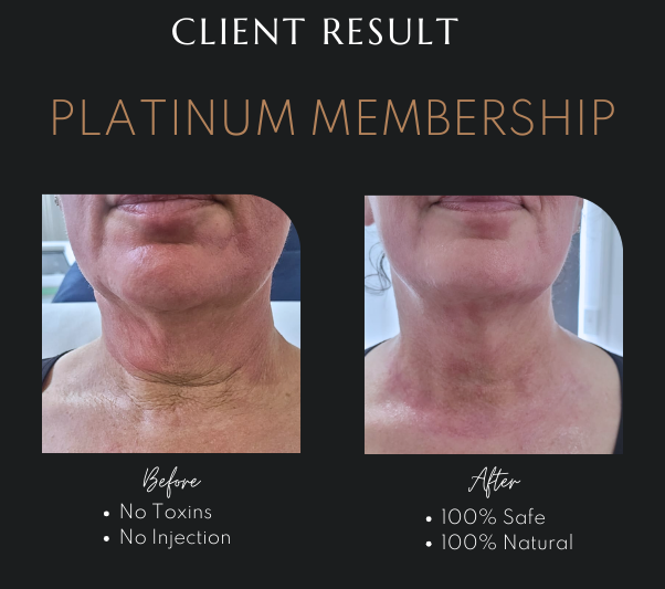 Laser Hair Removal in Newcastle